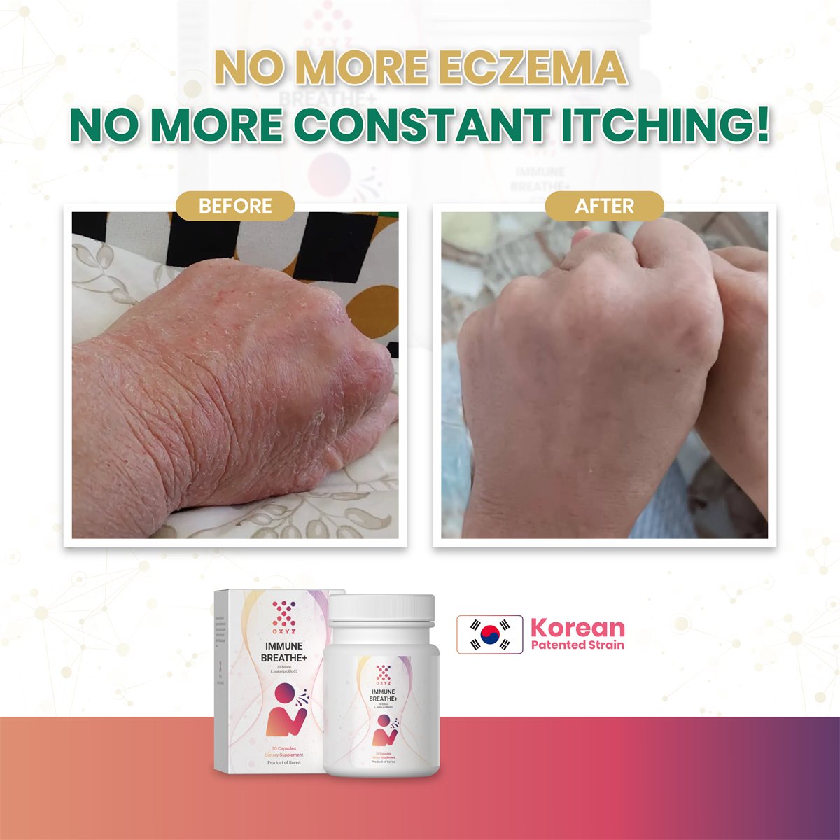 No more eczema, no more constant itching — before and after